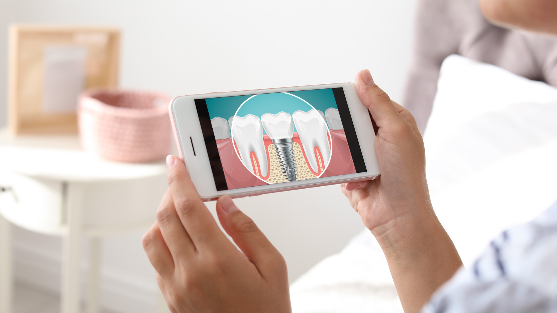 A person holding a smartphone displaying an image of a tooth with a cavity.