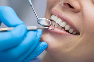 Dental hygiene professional using dental tools to clean teeth.