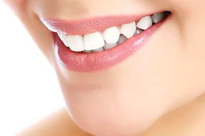 A close-up of a person s smiling face, showcasing their teeth and lips, with an emphasis on dental care or cosmetic enhancement.