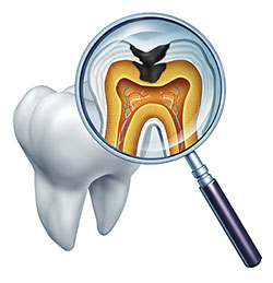 The image displays a magnified view of a tooth with an open crown, revealing the interior structure and the presence of a dental implant or screw. A magnifying glass with a detailed diagram of teeth and gums is superimposed over the tooth, highlighting its internal features.