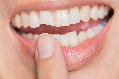 The image shows a person holding their finger over their mouth, presumably to prevent saliva from dripping out while they are brushing their teeth.