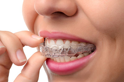 The image features a person holding a toothbrush and wearing a clear aligner, which is commonly used for teeth straightening.