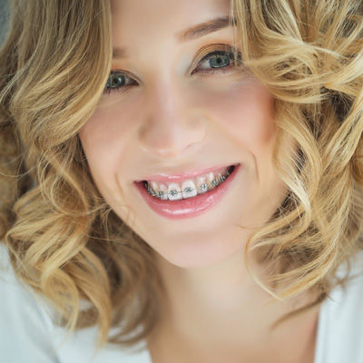 The image shows a smiling woman with braces, wearing a white top and curly hair.