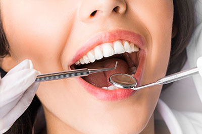 A woman with a mouthful of dental instruments, wearing gloves and a mask.