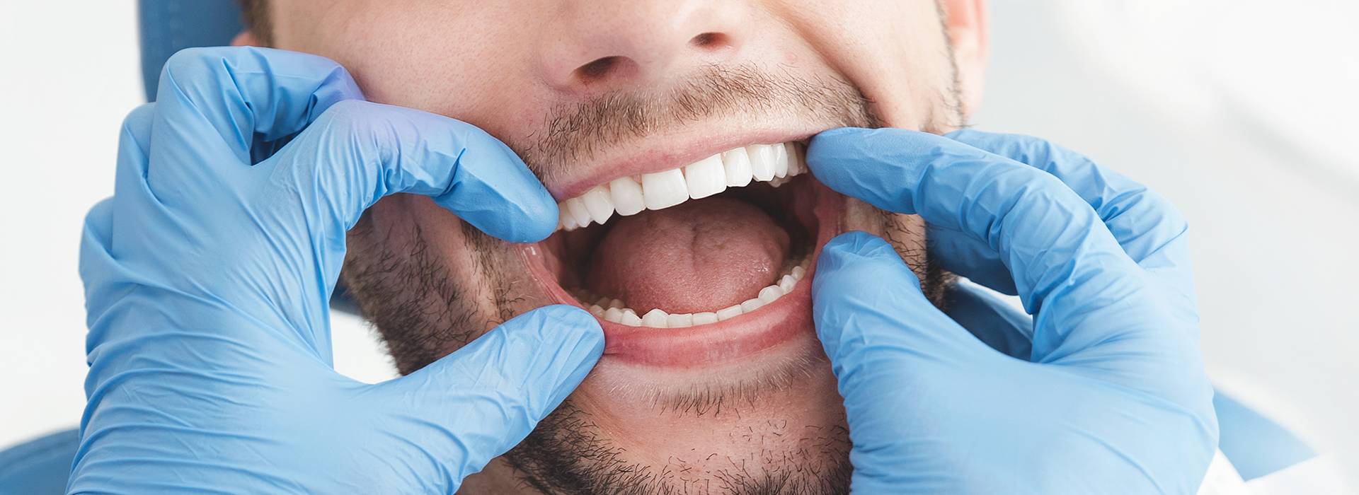 The image shows a man with his mouth open, wearing blue gloves and a white mask, possibly in a dental or medical setting.